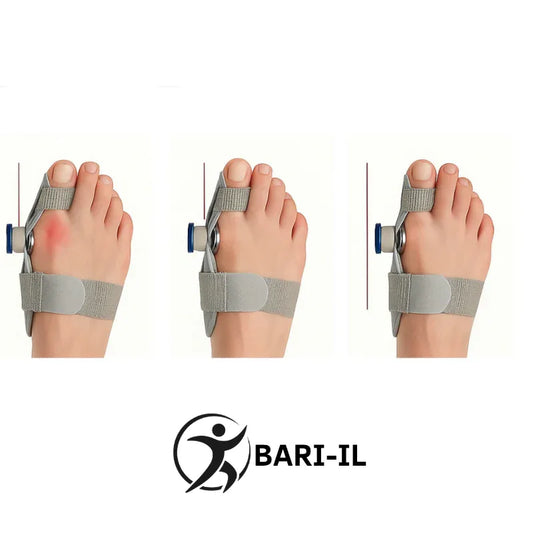 סד יישור לבוהן (הלוקס ולגוס) עם מפרק מתכוונן - BARI-IL